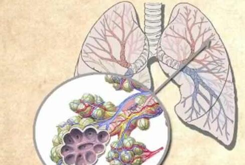 肺间质纤维化怎么办?肺病专家:并非不可逆的