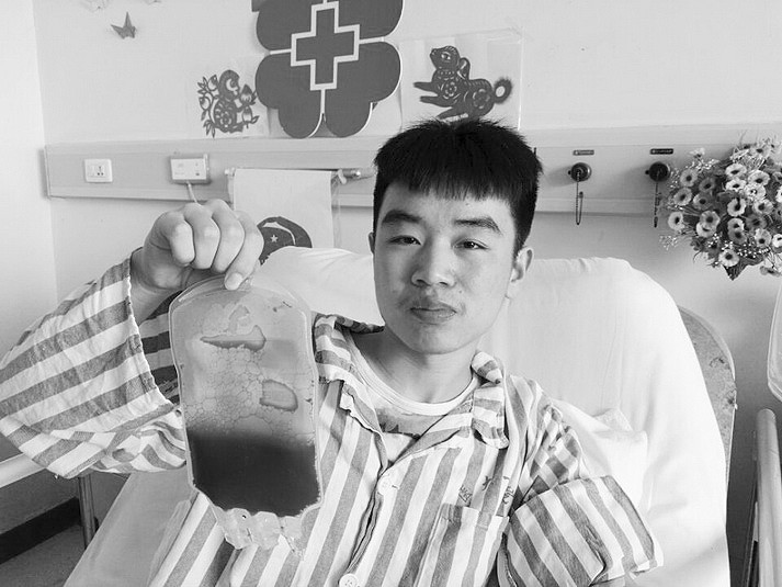 为救重庆患儿大医学生捐献造血干细胞-中国搜