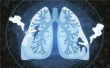 北京：新发恶性肿瘤　肺癌约占两成发病率上升
