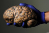 精神病医院收藏3千多颗人脑标本做研究